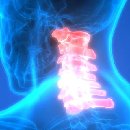 Spinal stenosis and degenerative conditions