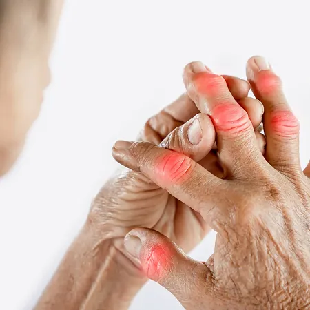 Joint stiffness, especially in the morning